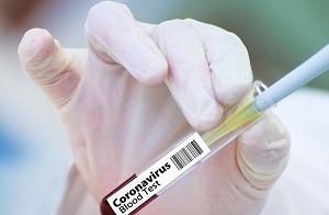Вакцина от коронавируса появилась в Новосибирске